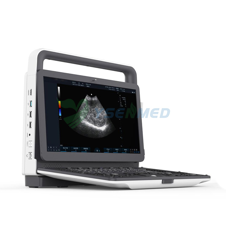 YSB-M30 Top Sale 3D 4D Portable Color Doppler Ultrasound Machine Scanner With Low Price