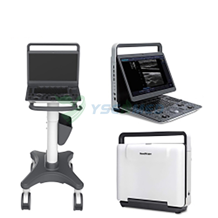 Sonoscape E2 portable colour doppler ultrasound machine