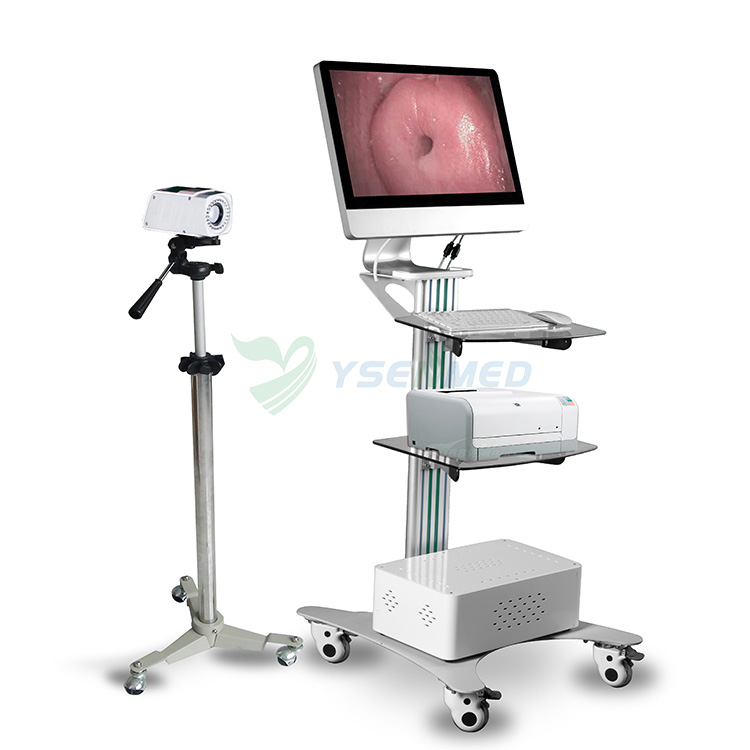 Gynecology Video Colposcope YSSW3303